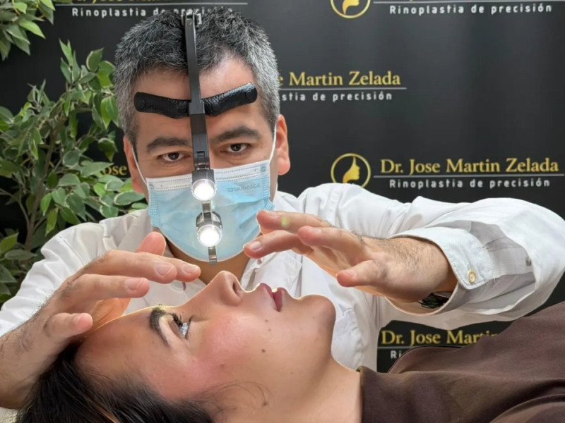 De Chachapoyas a Europa: el Dr. José Martín Zelada y la revolución de la rinoplastia híbrida en España